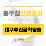 대구추간공확장술